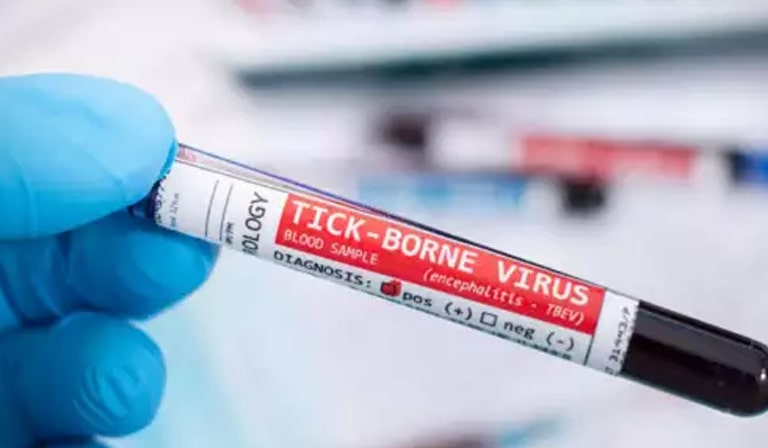 Tick borne virus